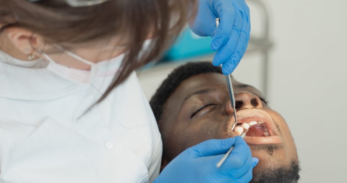 Five Reasons Why You Should Opt for Root Canal